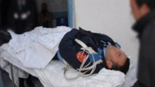 شاب يطعن شرطيا طعنات قاتلة ويحاول إنهاء حياته بأكادير