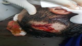 اقتحام منزل بالقليعة من طرف عصابة للكريساج و تهشيم رأس صاحبه