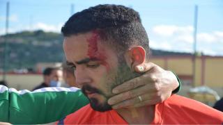 ضربة على مستوى الرأس ترسل حكم مبارة كرة قدم لمستعجلات تاونات