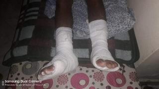 صدمته سيارة رجل سلطة ؛”قائد” … شاب بأكادير يطالب بفتح تحقيق ومساءلة المتورطين في الحادث