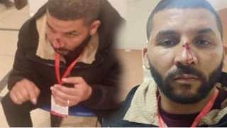 سخونية الراس .. بانون يعتذي بالضرب الجرح على مصور صحفي