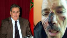 في ضل تماطل وزارة أخنوش … الرعاة الرحل يختطفون شابا بتزنيت ويكسرون عظام شاب بتارودانت