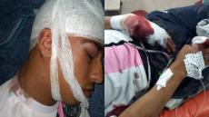 عصابة تهاجم شابا بالقليعة و ترسله في حالة حرجة لمستشفى إنزكان