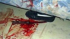 إمرأة بالدارالبيضاء تنتقم من خليلها وتبتر عضوه التناسلي